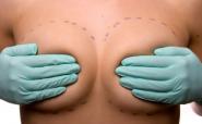 breasts prepared for cosmetic surgery