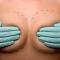 breasts prepared for cosmetic surgery