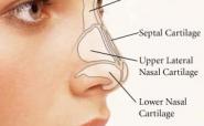 nose labelled for rhinoplasty